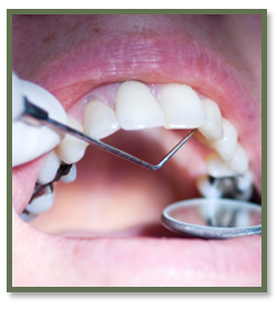 Get Fillings Fixed in Fort Worth