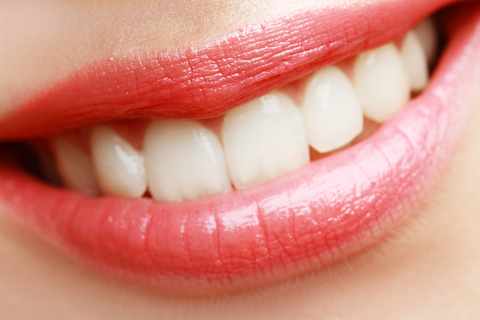 Teeth-Whitening-vs.-Veneers