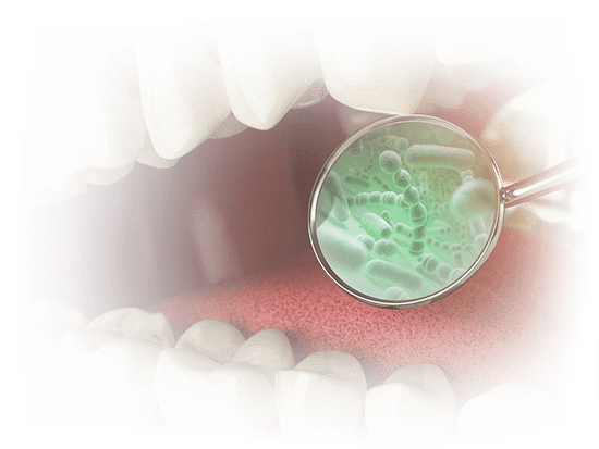 Gum Disease Graphic